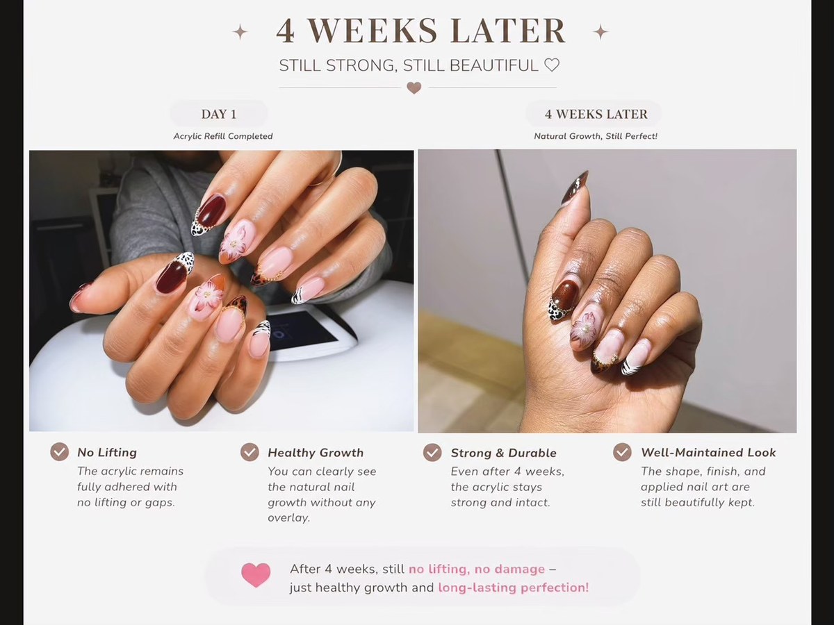 Four-week nail retention comparison