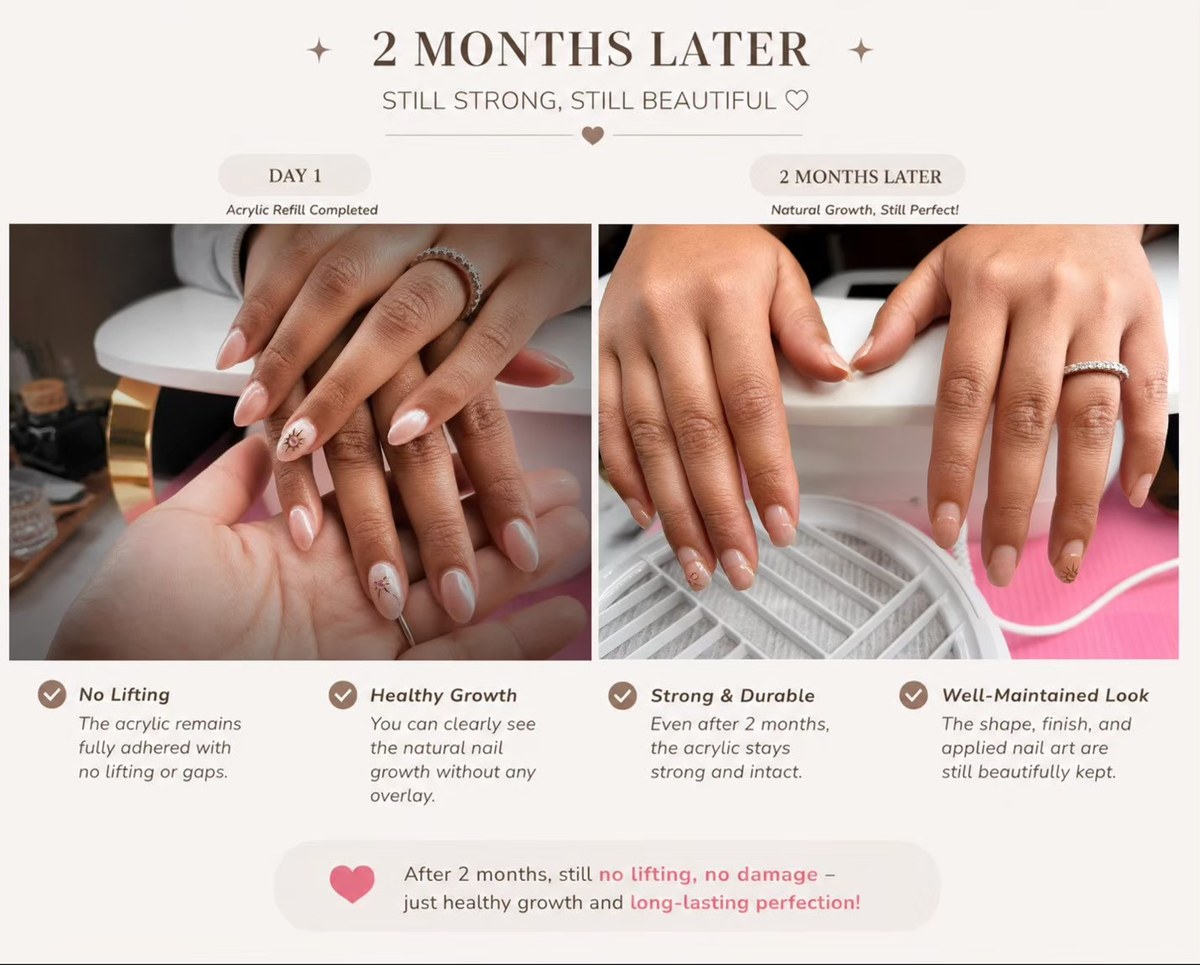 Two-month nail retention comparison